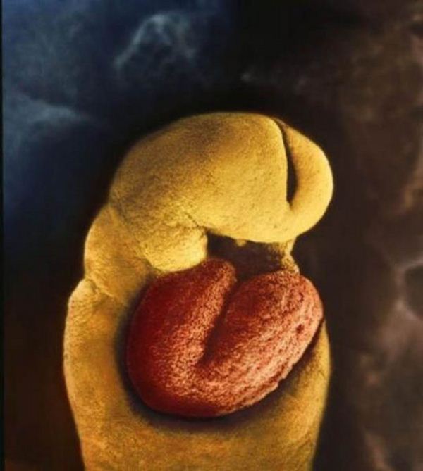  روز 24 ام قلب جنین شکل گرفته است.بعد از 18 روز قلب شروع به شکل گیری می کند.