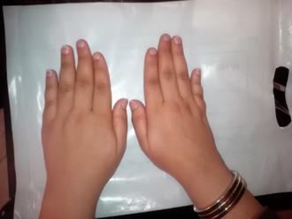 عمل زیبایی انگشتان دست