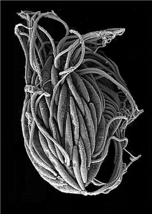 hypersality plankton