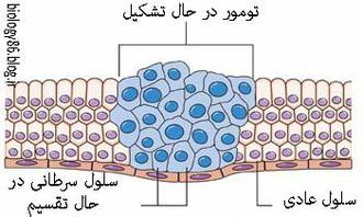 تومور سرطانی