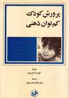 پرورش کودک کم توان ذهنی