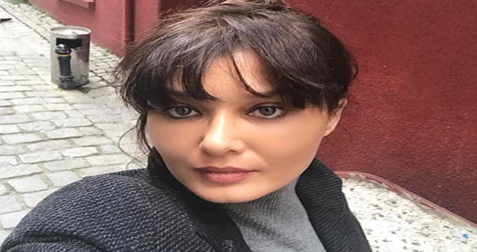 بازیگر معروف ترکیه، پشیمان از عمل زیبایی