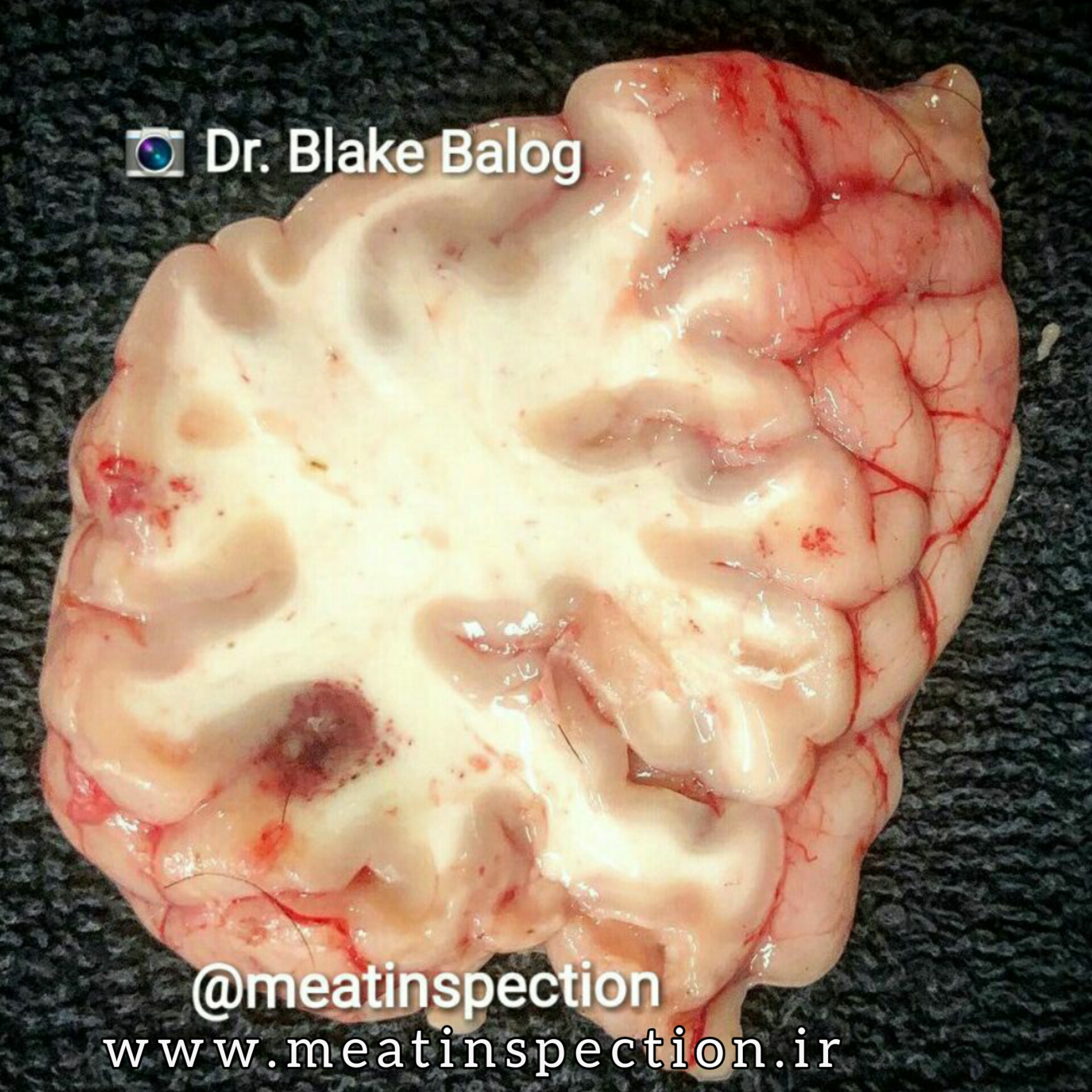 Infectious Thrombotic Meningoencephalitis