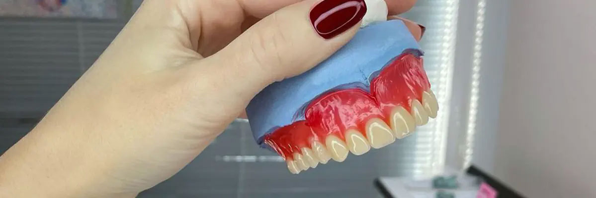 انواع دندان مصنوعی و قیمت آن