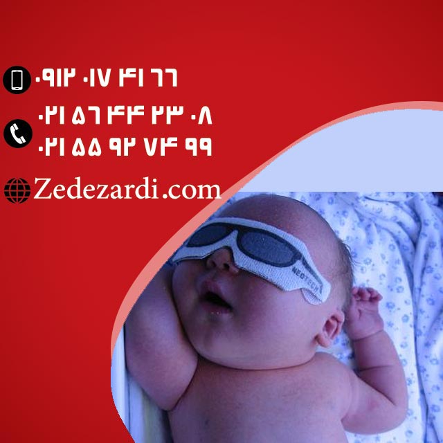 اجاره دستگاه ضد زردی با گارانتی اجاره دستگاه ضد زردی با گارانتی