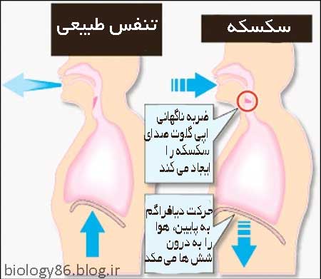 دلیل ایجاد سکسه