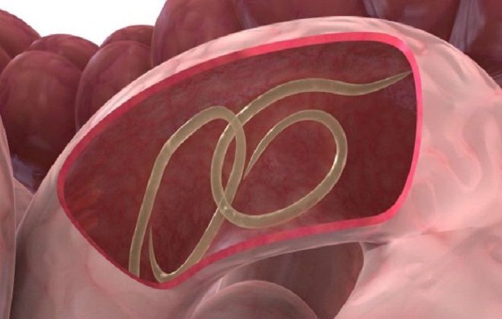 آسکاریس احتمال بارداری را افزایش می‌دهد