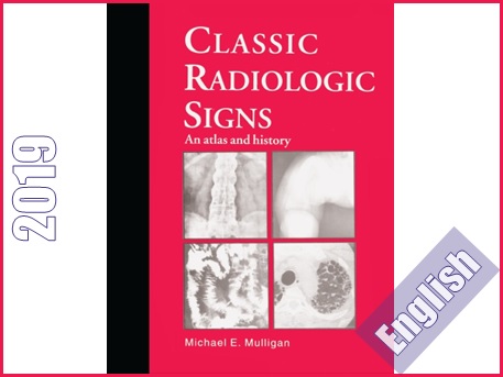 علائم کلاسیک رادیولوژی- اطلس و تاریخچه  Classic Radiologic Signs: An Atlas and History