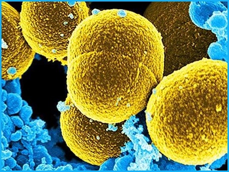 شناسایی درمان احتمالی بر ضد باکتری های مقاوم به آنتی بیوتیک مثل باکتری عامل سوزاک و مننژیت