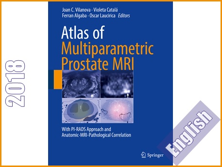 اطلس ام آر آی (MRI) چندپارامتری پروستات  Atlas of multiparametric prostate MRI : with PI-RADS approach and anatomic-MRI-pathological correlation