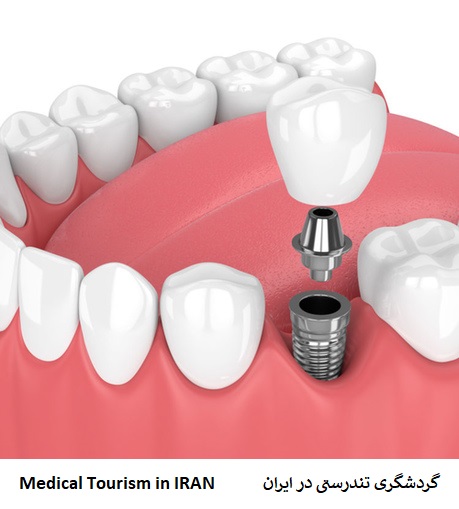 دندانپزشکی در ایران