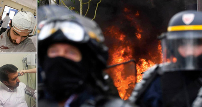 خبرنگار مصدوم صدا و سیما: پلیس فرانسه ما را قیچی کرد