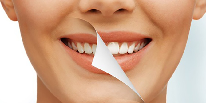 سفید کردن سریع دندان در فتوشاپ