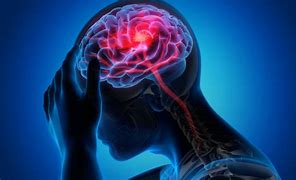 خاطرات یک سکته مغزی
