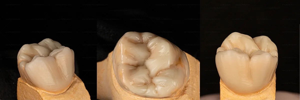 آناتومی دندان، عملکرد و بیماری‌های رایج