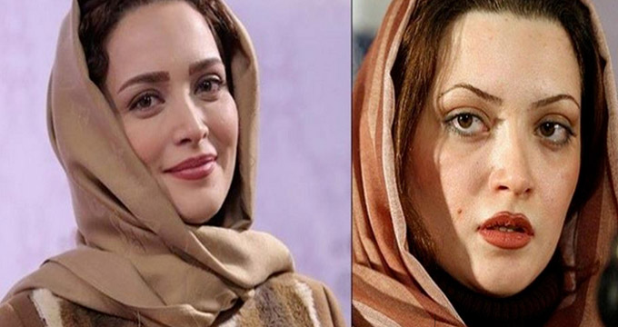 تفاوت خیره‌کننده چهره «بهنوش طباطبایی» قبل و بعد از عمل