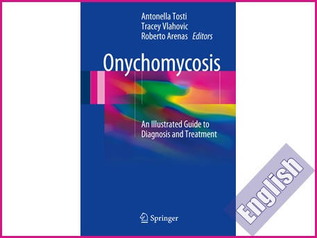 کتاب راهنمای تصویری تشخیص و درمان عفونت قارچی پا  Onychomycosis: An Illustrated Guide to Diagnosis and Treatment