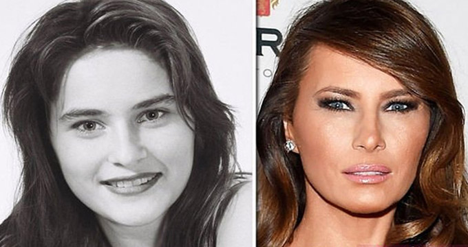 عکس/دختر ترامپ، قبل و بعد از جراحی