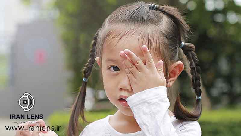علت  تنبلی چشم در کودکان
