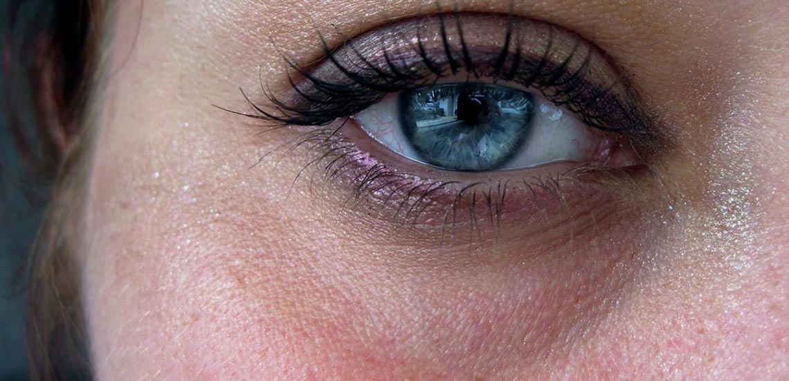 درمان سیاهی دور چشم با ۱۰ روش کاملا طبیعی