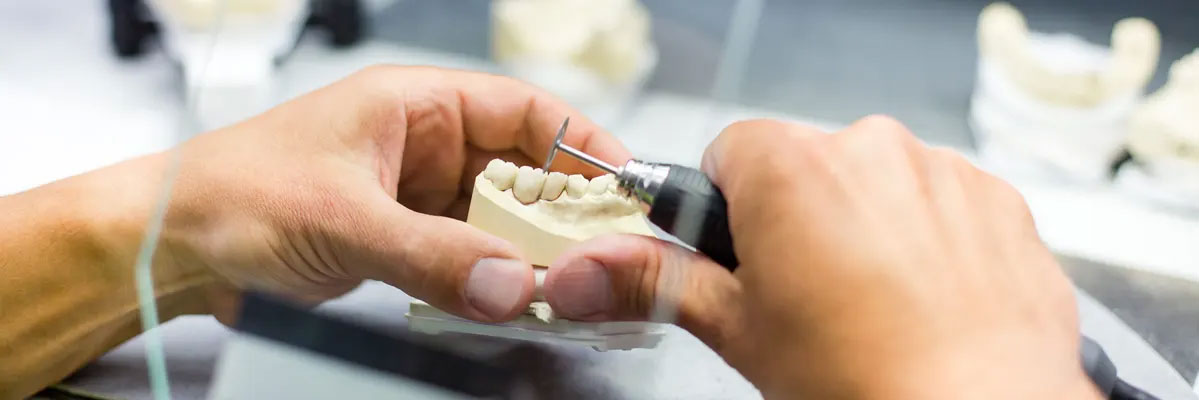 چه نوع پروتزهایی در لابراتوار دندانسازی ساخته می‌شود؟