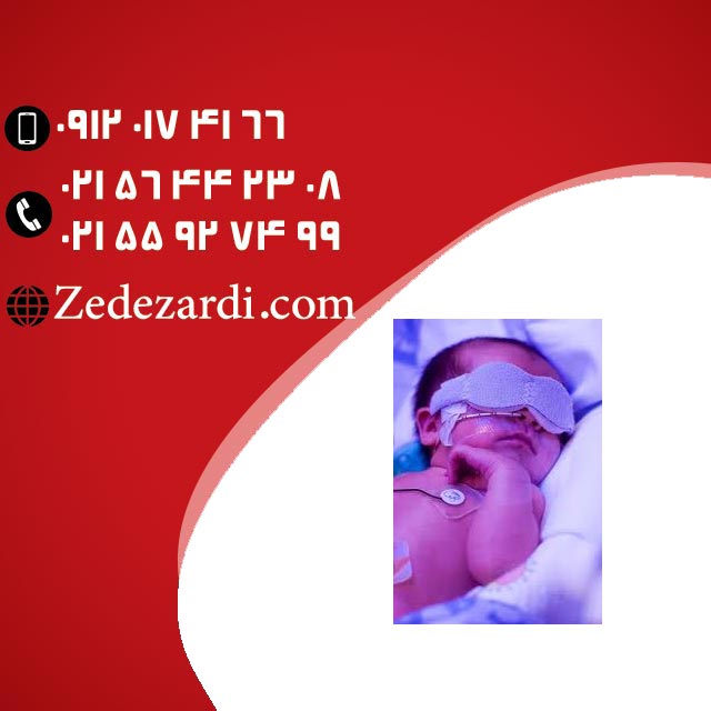 فروش و اجاره دستگاه ضد زردی و درمان زردی در منزل فروش و اجاره دستگاه ضد زردی و درمان زردی در منزل