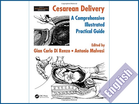 کتاب راهنمای جامع تصویری و کاربردی زایمان سزارین  Cesarean delivery: a comprehensive illustrated practical guide