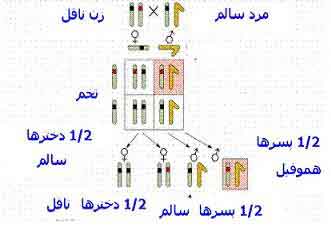 بیماری هموفیلی