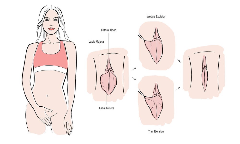 دانستنی درباره واژن زن ها و انواع واژن و بکارت