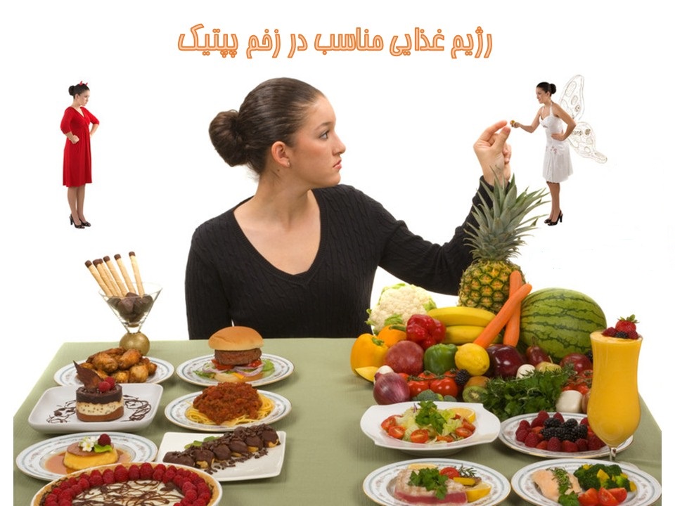 رژی غذایی مناسب در زخم معده