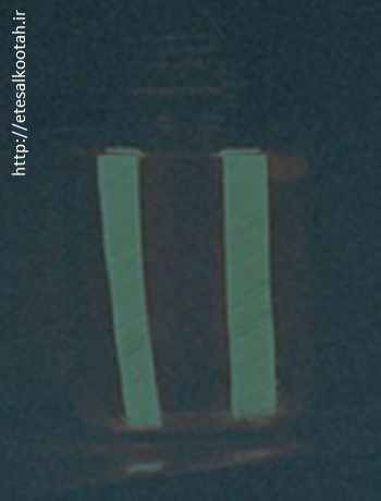 تابش نور فلوئورسانس از الکترودهای یکسوساز الکترولیتی ثبت شده در سال 2003 توسط رادیوآماتوری به نام نایل استاینر