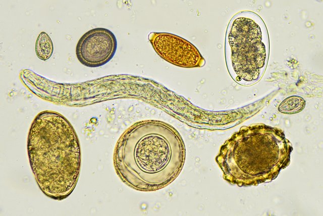 fecal-analysis-stool-analysis-nursing-responsibilities-nurseslabs