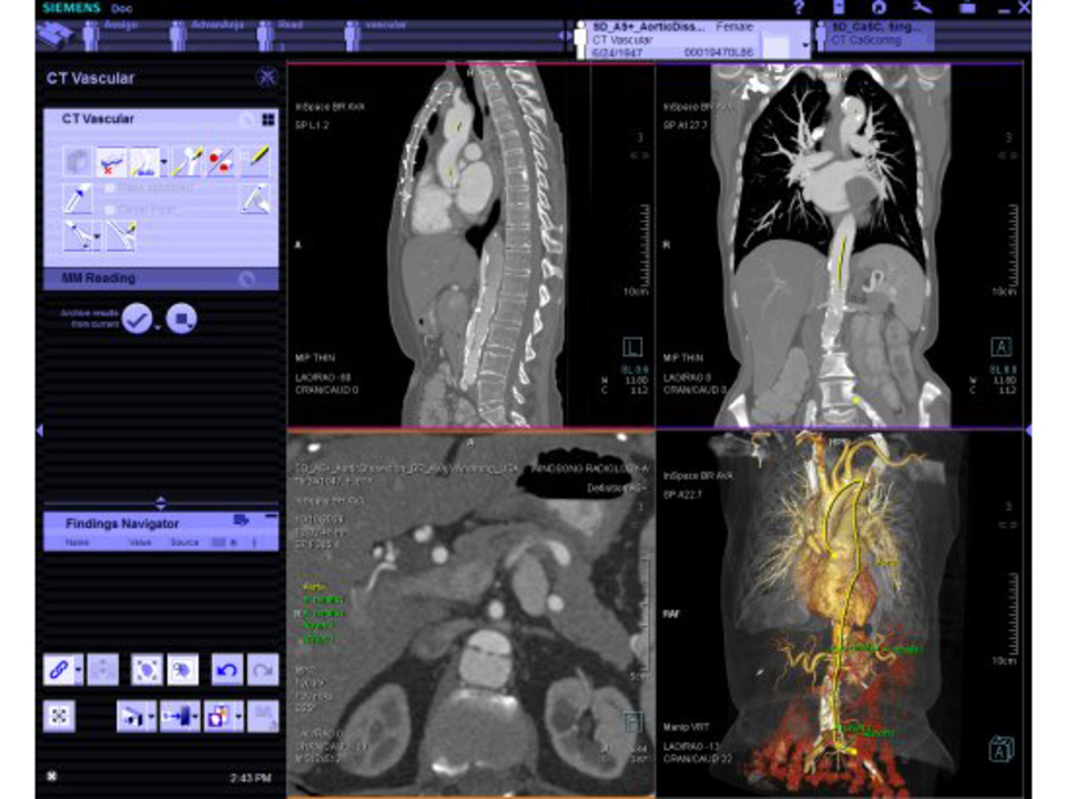 نرم افزار Syngo fastview مشاهده تصاویر DICOM