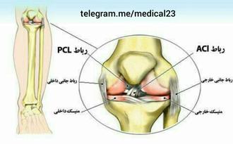 اسیب  استخوان زانو