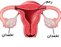 کم کاری تخمدان چیست