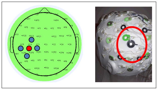 hd-tdcs.jpg