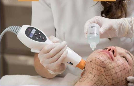 محل‌ های مناسب برای انجام هایفوتراپی