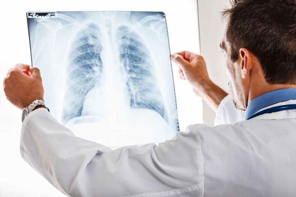 آشنایی مختصر با رادیوگرافی قفسه سینه CXR :: ضوابط و مقررات نسخ پاراکلینیک