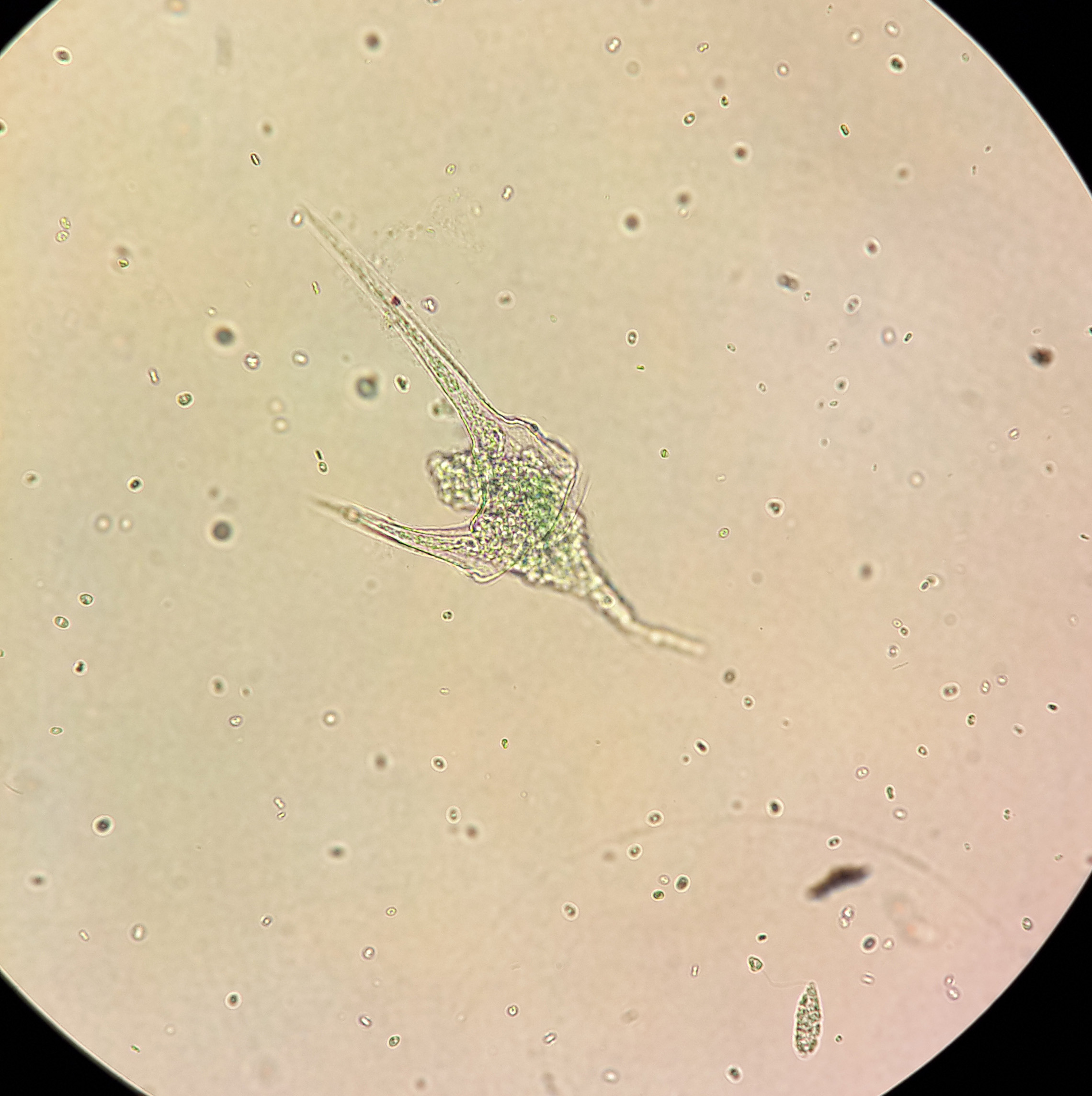 آمیب - Amoeba