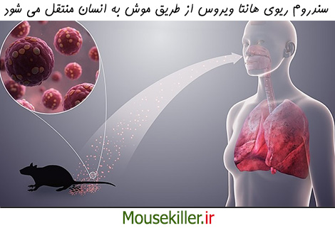 سندروم ریوی هانتاویروس