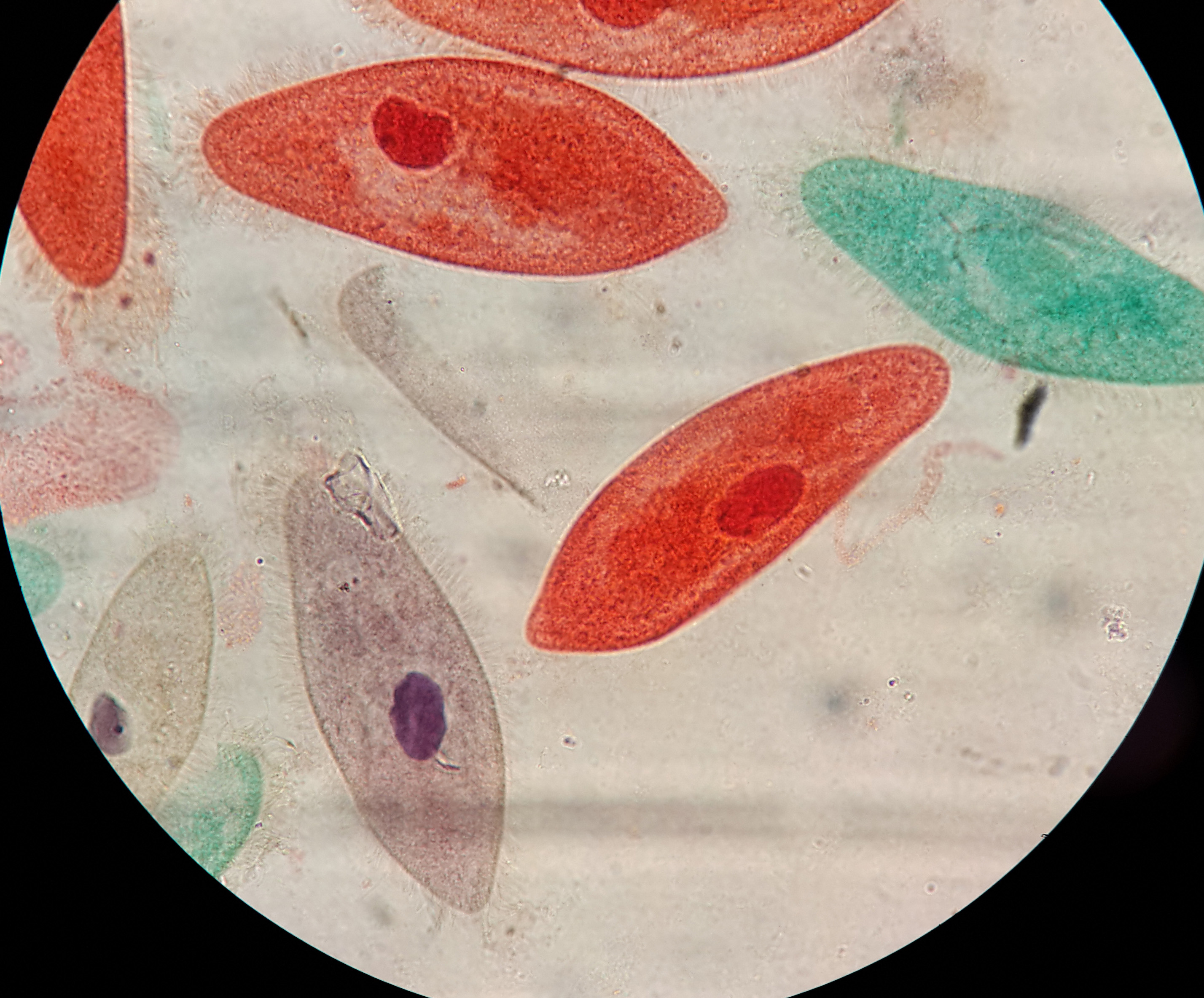 پارامسی-Paramecium