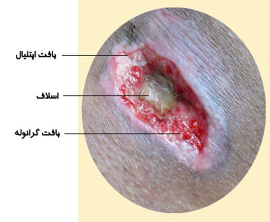 بافت گرانوله جیست؟