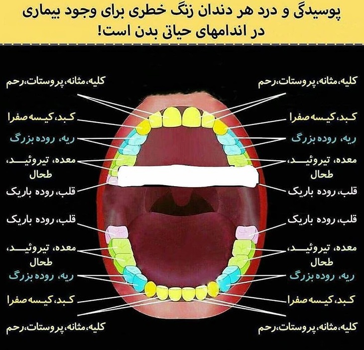 سلامت دندان و سلامت بدن