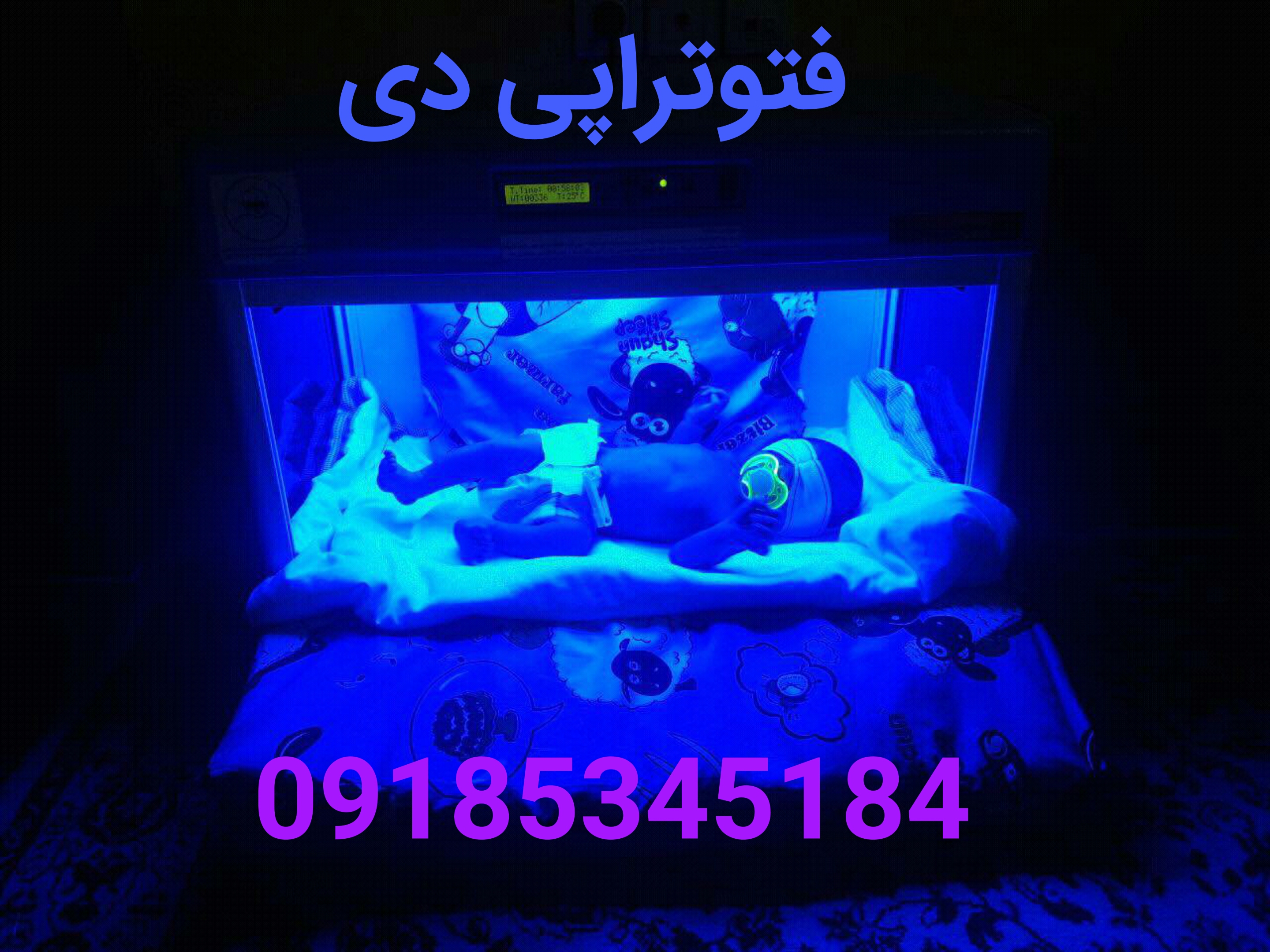 اجاره دستگاه زردی نوزادان در کرمانشاه  09185345184  فتوتراپی دی