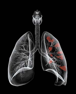 LUngs