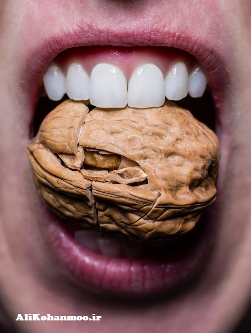 سلامت دندان قسمت آخر