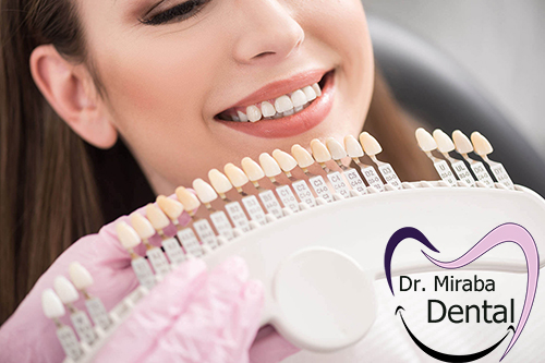 کامپوزیت دندان