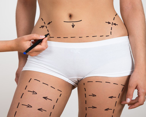 چگونه لاغر شویم؟