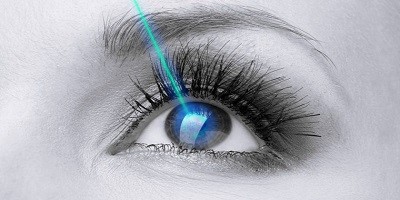 عمل لیزیک چشم