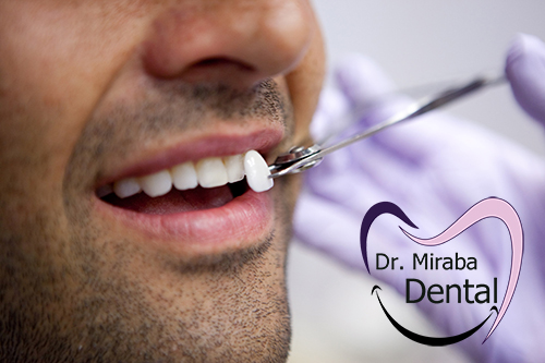 کامپوزیت دندان